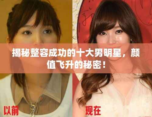 揭秘整容成功的十大男明星,颜值飞升的秘密!